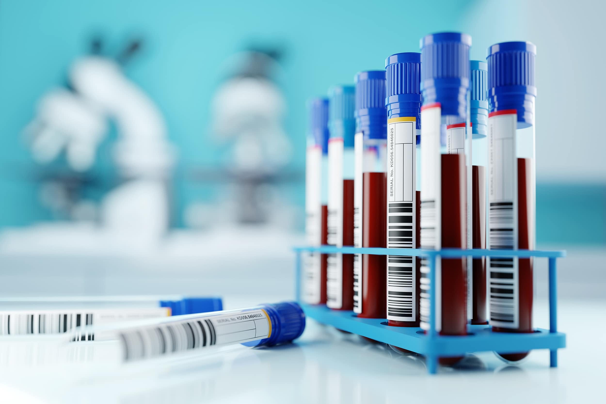NHLS Scrambles as Pathology Services Funding Runs Dry